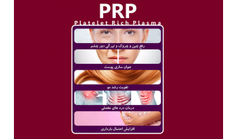 استفاده از پلاسمای غنی از پلاکت در مرکز درمان ناباروری رویا